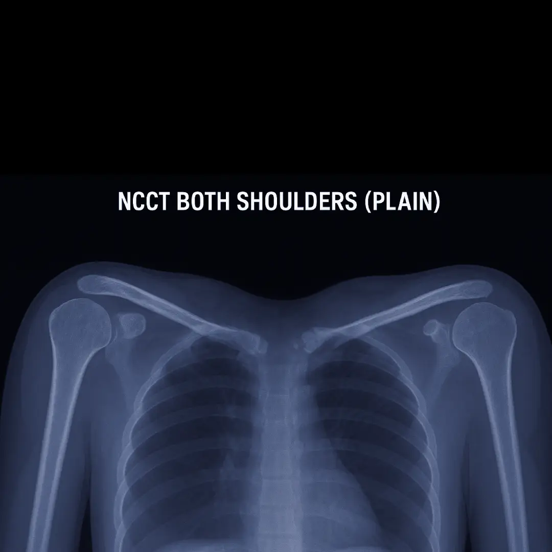 CECT Both Shoulders (Contrast)