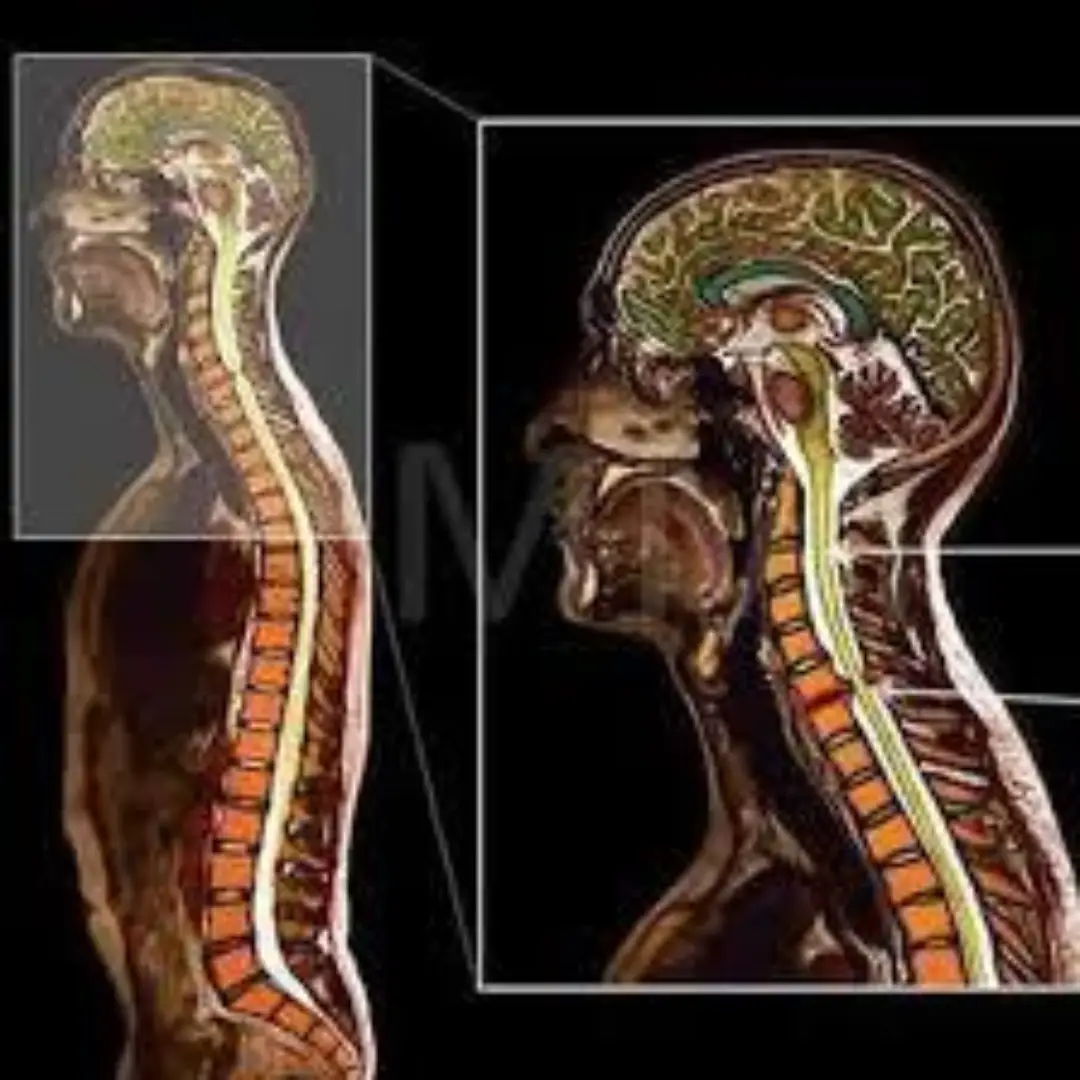 NCCT CERVICAL SPINE (PLAIN)