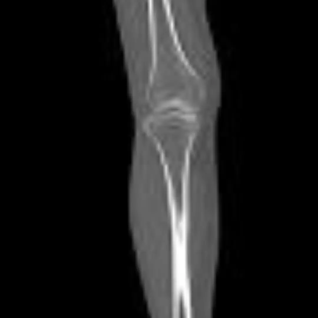 NCCT SINGLE KNEE (PLAIN)