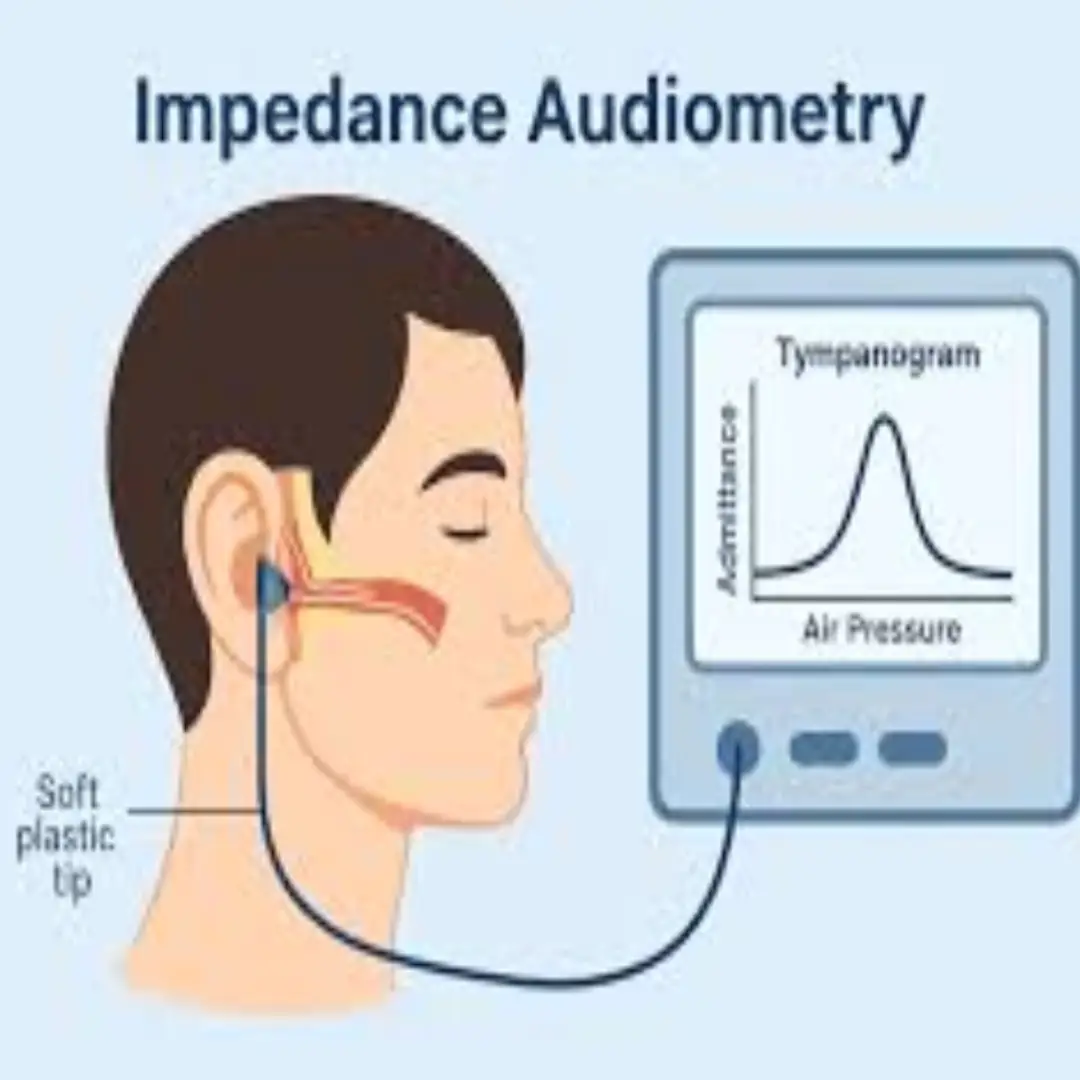 TYMPANOMETRY / IMPEDANCE