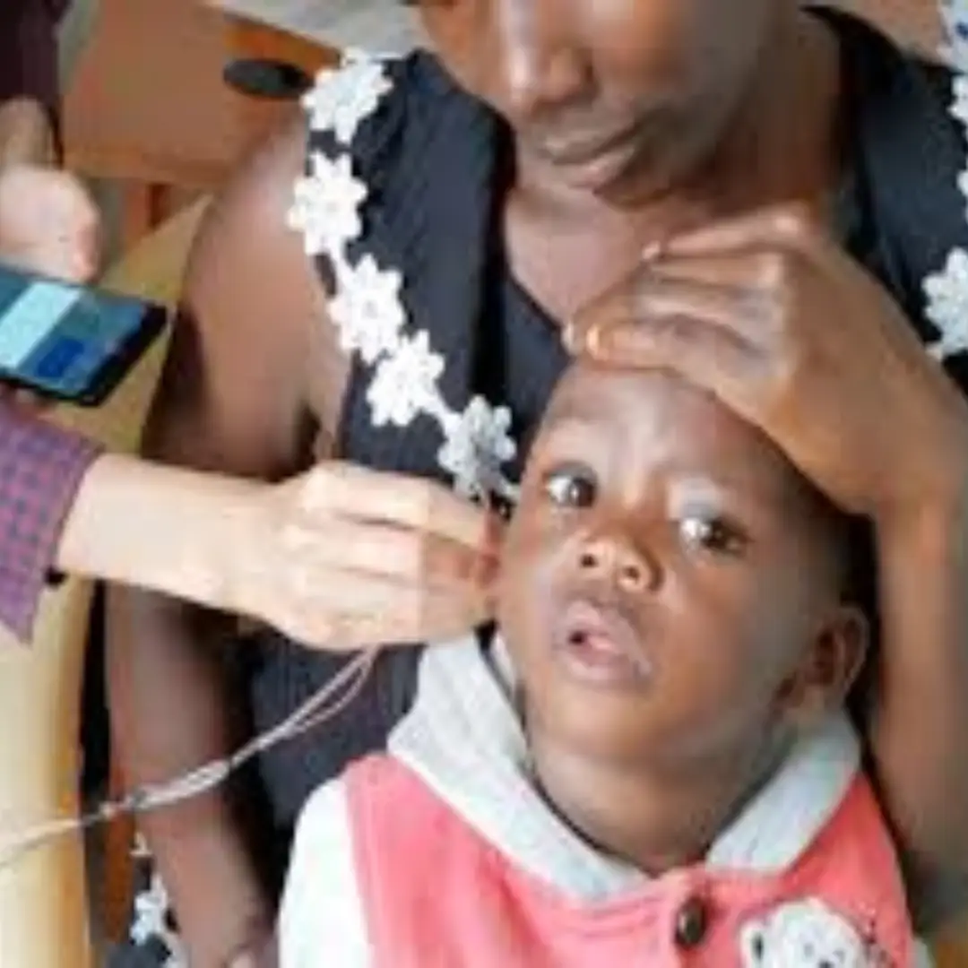 OAE – OTOACOUSTIC EMISSION